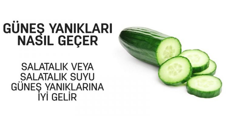 Güneş Yanıkları Nasıl Geçer, Evde Uygulayabileceğiniz Yöntemler